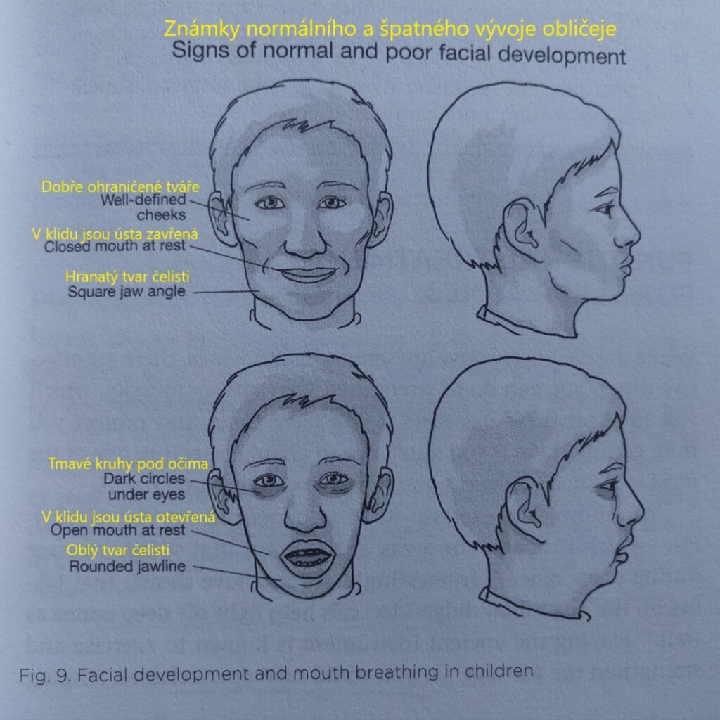 DentalDiet - vývoj obličeje